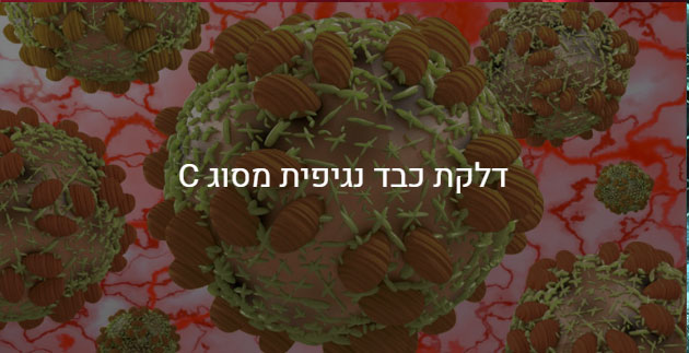 דלקת נגיפית מסוג C